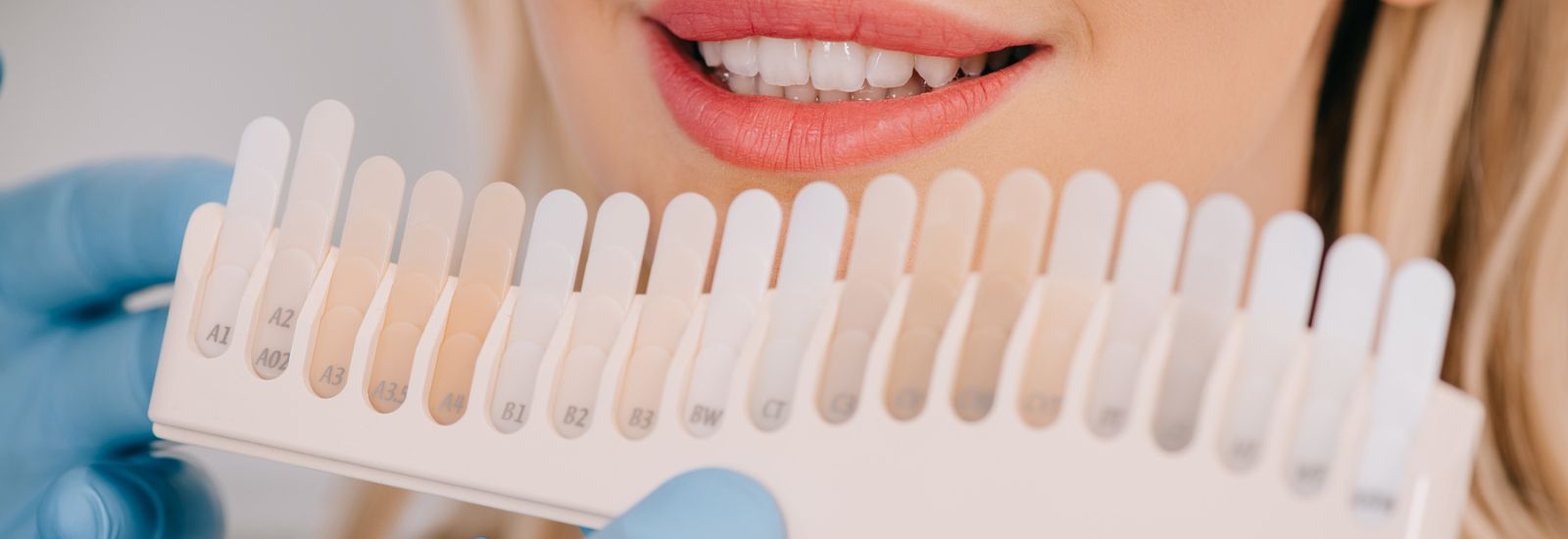 Woman with a teeth whitening chart